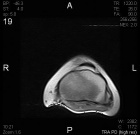 Zoom image: Radiological image