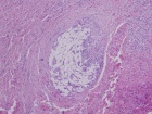 Zoom image: Cell stain