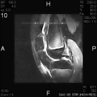 Zoom image: Radiological image