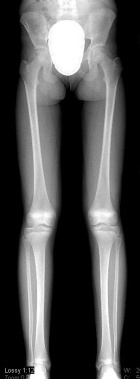 Zoom image: Radiological image