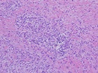 Zoom image: Cell stain