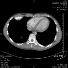 Zoom image: Radiological image