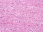 Zoom image: Cell stain