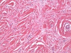 Zoom image: Cell stain