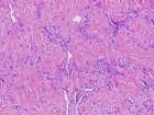 Zoom image: Cell stain