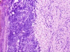 Zoom image: Cell stain