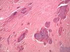 Zoom image: Cell stain