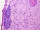 Zoom image: Cell stain
