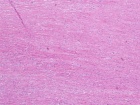 Zoom image: Cell stain