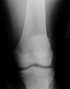 Zoom image: Radiological image