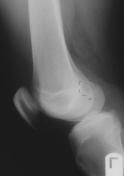 Zoom image: Radiological image