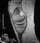 Zoom image: Radiological image