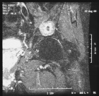 Zoom image: Radiological image