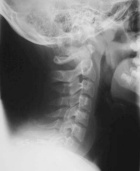 Zoom image: Radiological image