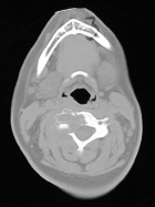Zoom image: Radiological image