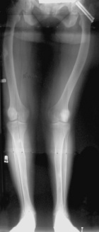 Zoom image: Radiological image