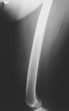 Zoom image: Radiological image