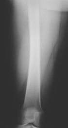 Zoom image: Radiological image