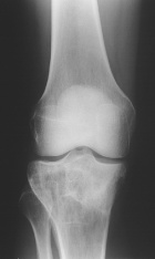 Zoom image: Radiological image