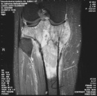 Zoom image: Radiological image