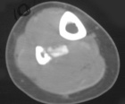 Zoom image: Radiological image