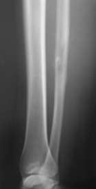 Zoom image: Radiological image