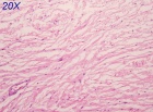 Zoom image: Cell stain