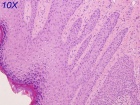 Zoom image: Cell stain