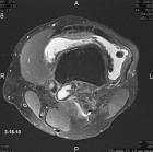 Zoom image: Radiological image