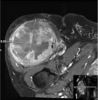 Zoom image: Radiological image
