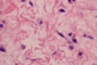 Zoom image: Cell stain