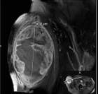 Zoom image: Radiological image