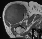 Zoom image: Radiological image