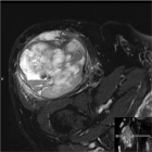 Zoom image: Radiological image