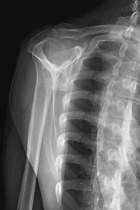 Zoom image: Radiological image