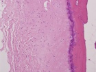 Zoom image: Cell stain