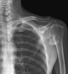 Zoom image: Radiological image