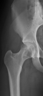 Zoom image: Radiological image