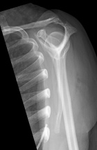 Zoom image: Radiological image