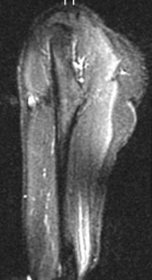Zoom image: Radiological image