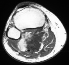 Zoom image: Radiological image