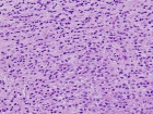 Zoom image: Cell stain