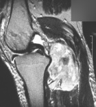 Zoom image: Radiological image