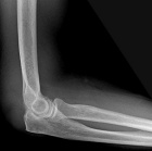 Zoom image: Radiological image