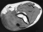 Zoom image: Radiological image