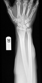 Zoom image: Radiological image