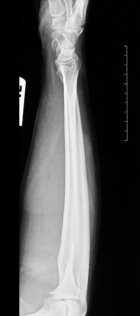 Zoom image: Radiological image