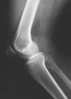 Zoom image: Radiological image