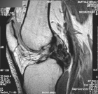 Zoom image: Radiological image