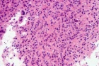Zoom image: Cell stain
